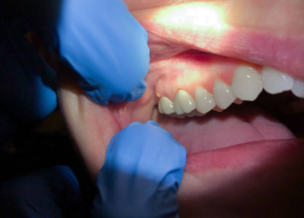 Best Emergency Dentist Open Today  in Houserville, PA