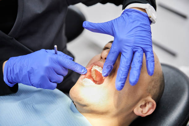 Best Dentist for Tooth Abscess  in Houserville, PA