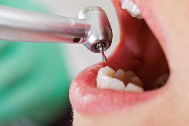 Best Cracked Tooth Emergency Dentist  in Houserville, PA